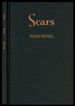 Scars