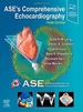 Ase's Comprehensive Echocardiography