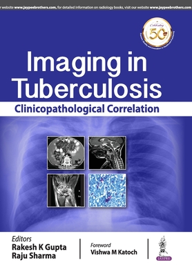 Imaging in Tuberculosis: Clinicopathological Correlation - Gupta, Rakesh K, and Sharma, Raju