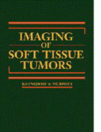 Imaging of Soft Tissue Tumors