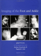 Imaging of the Foot and Ankle