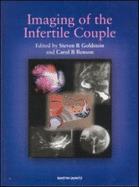 Imaging of the Infertile Couple