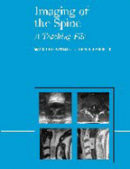 Imaging of the Spine: A Teaching File