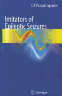 Imitators of Epileptic Seizures