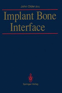 Implant bone interface