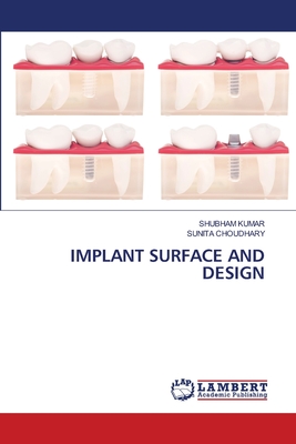Implant Surface and Design - Kumar, Shubham, and Choudhary, Sunita
