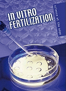 In-vitro Fertilization