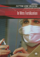 In Vitro Fertilization