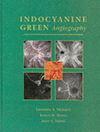 Indocyanine Green Angiography