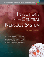 Infections of the Central Nervous System