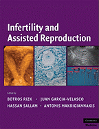 Infertility and Assisted Reproduction - Rizk, Botros R. M. B., MD, MA, FACOG, FACS, FRCS (Editor), and Garcia-Velasco, Juan A. (Editor), and Sallam, Hassan N. (Editor)