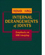 Internal Derangements of Joints: Emphasis on MR Imaging