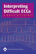 Interpreting Difficult ECGs: A Rapid Reference