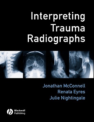 Interpreting Trauma Radiographs - McConnell, Jonathan (Editor), and Eyres, Renata (Editor), and Nightingale, Julie (Editor)