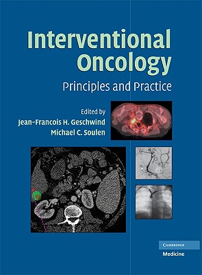 Interventional Oncology: Principles and Practice - Geschwind, Jean-Fran�ois H (Editor), and Soulen, Michael C (Editor)
