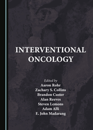 Interventional Oncology
