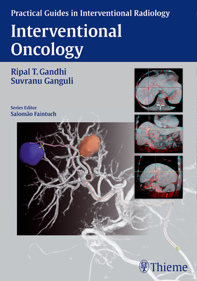 Interventional Oncology - Gandhi, Ripal (Editor), and Ganguli, Suvranu (Editor)
