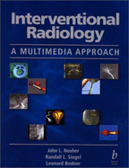 Interventional Radiology: A Multimedia Approach
