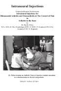 Intraneural Injections