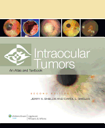 Intraocular Tumors: An Atlas and Textbook