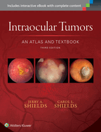 Intraocular Tumors: An Atlas and Textbook