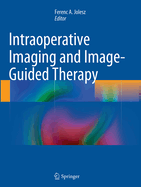 Intraoperative Imaging and Image-Guided Therapy