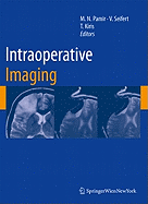 Intraoperative Imaging