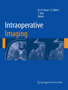 Intraoperative Imaging