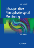 Intraoperative Neurophysiological Monitoring