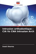 Intrusion orthodontique: CIA Vs CNA Intrusion Arch