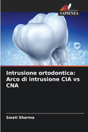 Intrusione ortodontica: Arco di intrusione CIA vs CNA