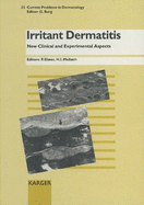 Irritant Dermatitis: New Clinical and Experimental Aspects