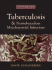 Tuberculosis and Nontuberculosis Mycobacterial Infections