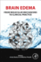 Brain Edema: From Molecular Mechanisms to Clinical Practice 1ed