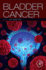 Bladder Cancer