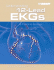 Understanding 12-Lead Ekgs: a Practical Approach