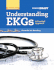 Understanding Ekgs: a Practical Approach