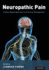 Neuropathic Pain: A Case-Based Approach to Practical Management