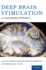 Deep Brain Stimulation