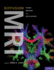 Diffusion Mri