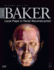 Local Flaps in Facial Reconstruction: Text With Dvd