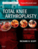 Total Knee Arthroplasty, 2e