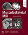 Musculoskeletal Mri