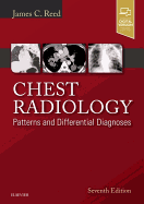 Chest Radiology