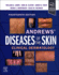 Andrews' Diseases of the Skin: Clinical Dermatology 14ed