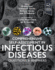 Comprehensive Self-Assessment in Infectious Disease: Questions and Answers