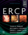 Ercp