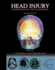 Head Injury: Pathophysiology and Management (2nd Edition)