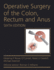 Operative Surgery of the Colon Rectum and Anus 6ed (Hb 2015)