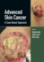 Advanced Skin Cancer: A Case-Based Approach